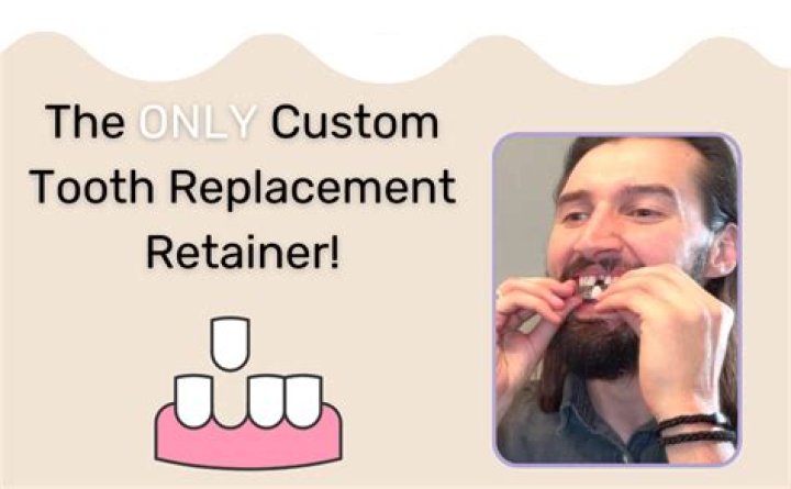 Temporary Replacement: Part 2 & 3 Explained